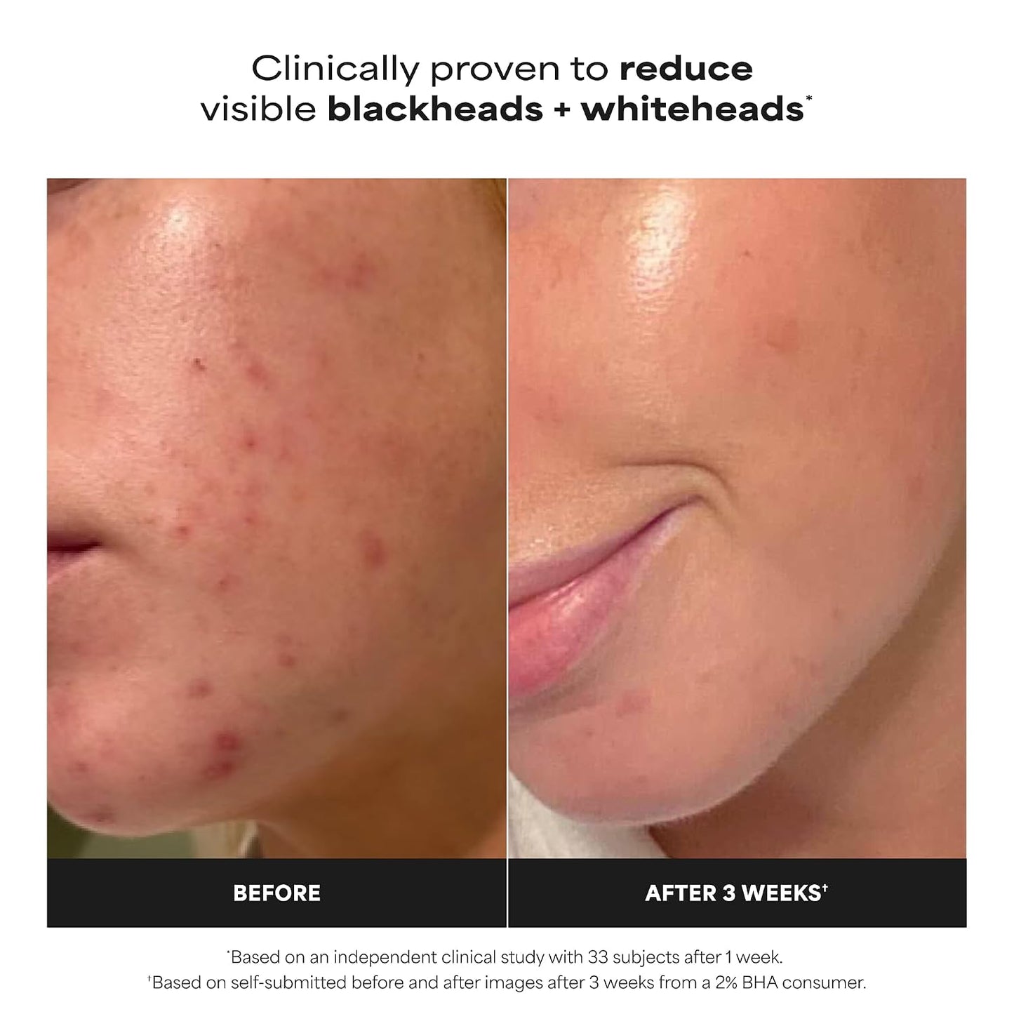 Reveal Clear, Glowing Skin: Unclog Pores and Smooth Fine Lines Instantly