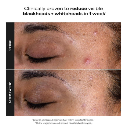 Reveal Clear, Glowing Skin: Unclog Pores and Smooth Fine Lines Instantly
