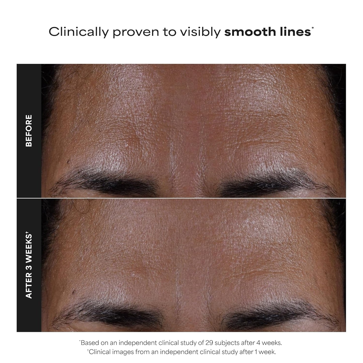 Reveal Clear, Glowing Skin: Unclog Pores and Smooth Fine Lines Instantly