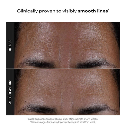 Reveal Clear, Glowing Skin: Unclog Pores and Smooth Fine Lines Instantly
