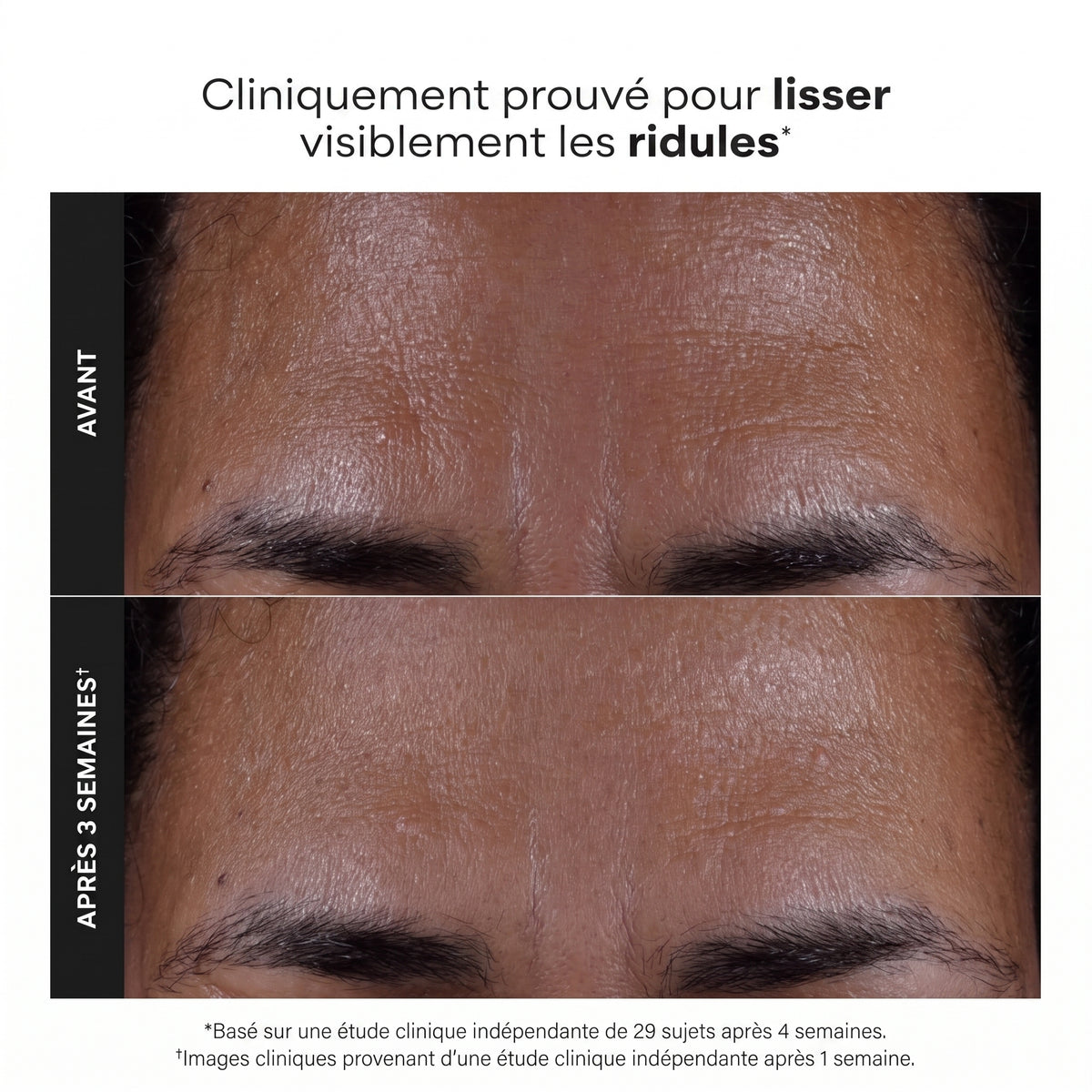 Révélez une Peau Éclatante : Des Pores Nettoyés et des Ridules Lissées 118 ml