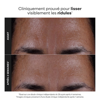 Révélez une Peau Éclatante : Des Pores Nettoyés et des Ridules Lissées 118 ml