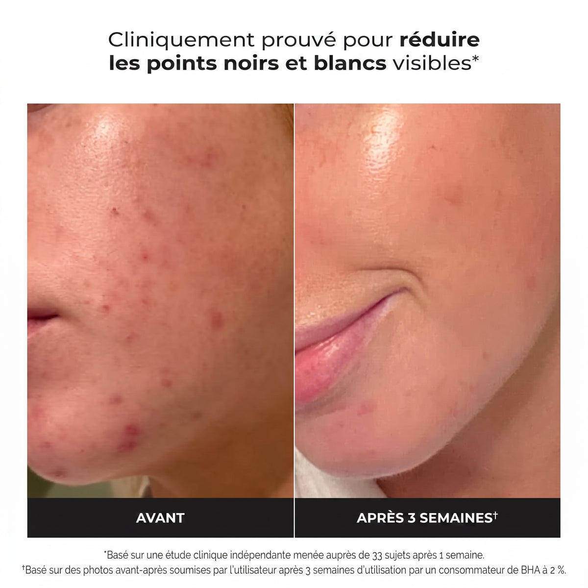 Révélez une Peau Éclatante : Des Pores Nettoyés et des Ridules Lissées 118 ml