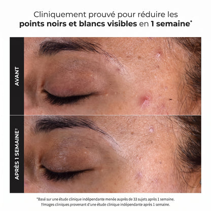 Révélez une Peau Éclatante : Des Pores Nettoyés et des Ridules Lissées 118 ml